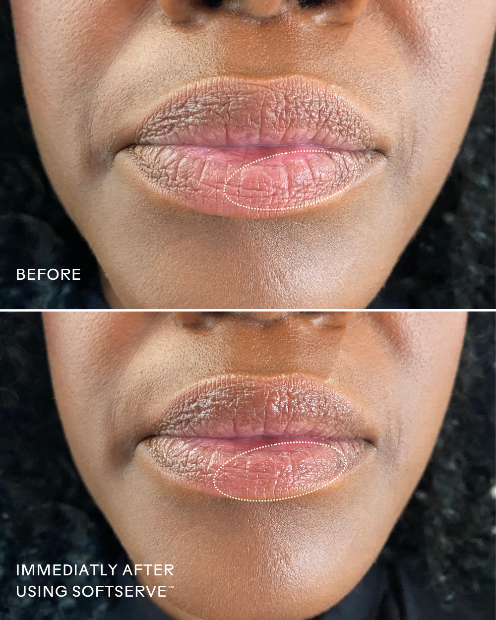 SoftServe™ Pomegranate + Shea Butter Barrier-Building Lip Treatment